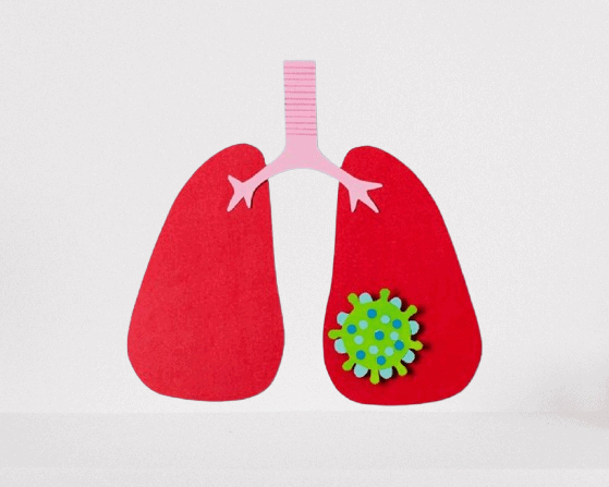 Tarlatamab (Imdelltra) A New Hope for Small Cell Lung Cancer